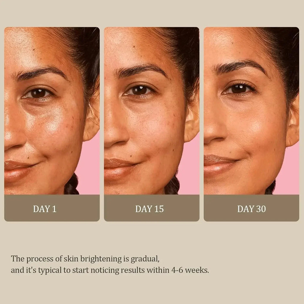 Turmeric Kojic Acid Soap Dark Spot & Acne Removal