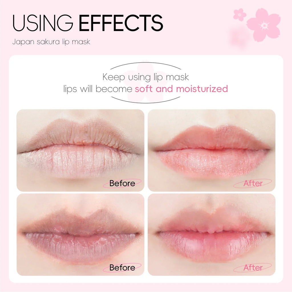 LAIKOU Lip Care Mask Moisturizing Hydrating Repair Patches