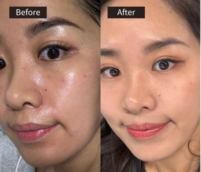 Original Korea SkinCare REJURAN Face Cream